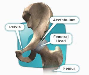 totalhipreplacement_1