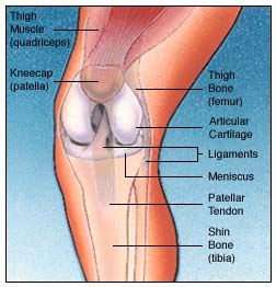 totalkneereplacement_1